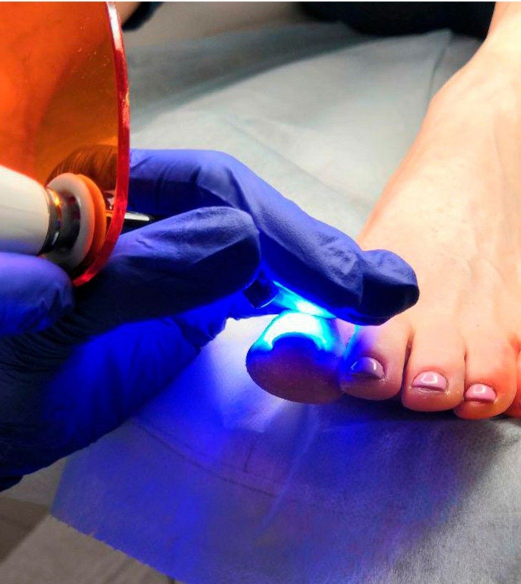 Pedicure Clínico en Cali - Glems Cali